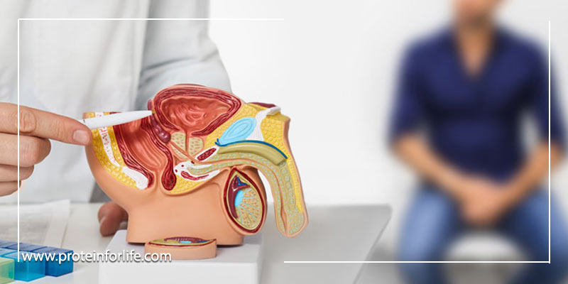 بهبود پروستات در مردان